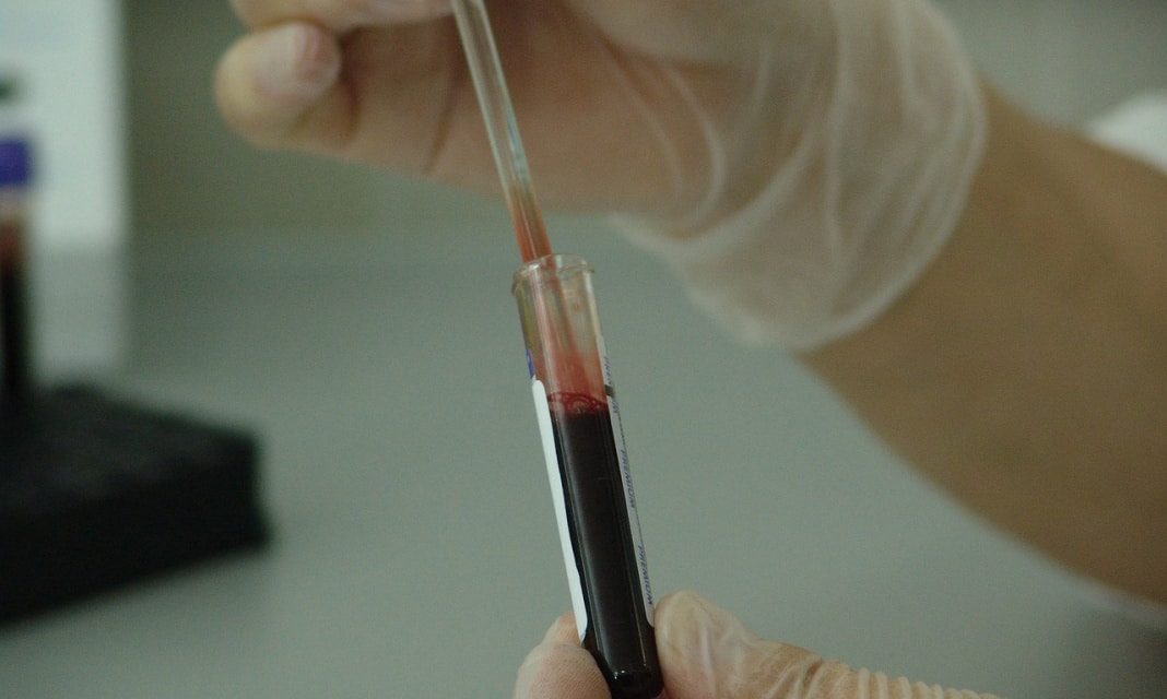 Jak poprawić saturację krwi?